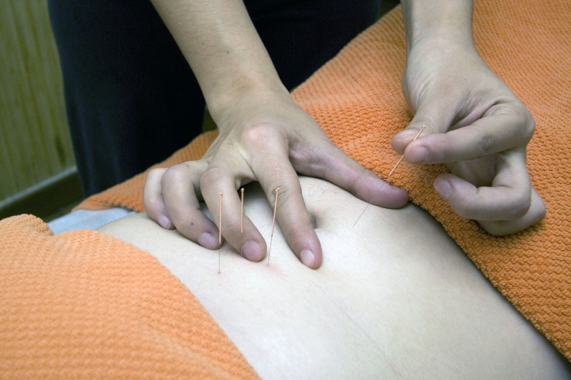 osteopathe-REGUSSE-min_acupuncture-4175625